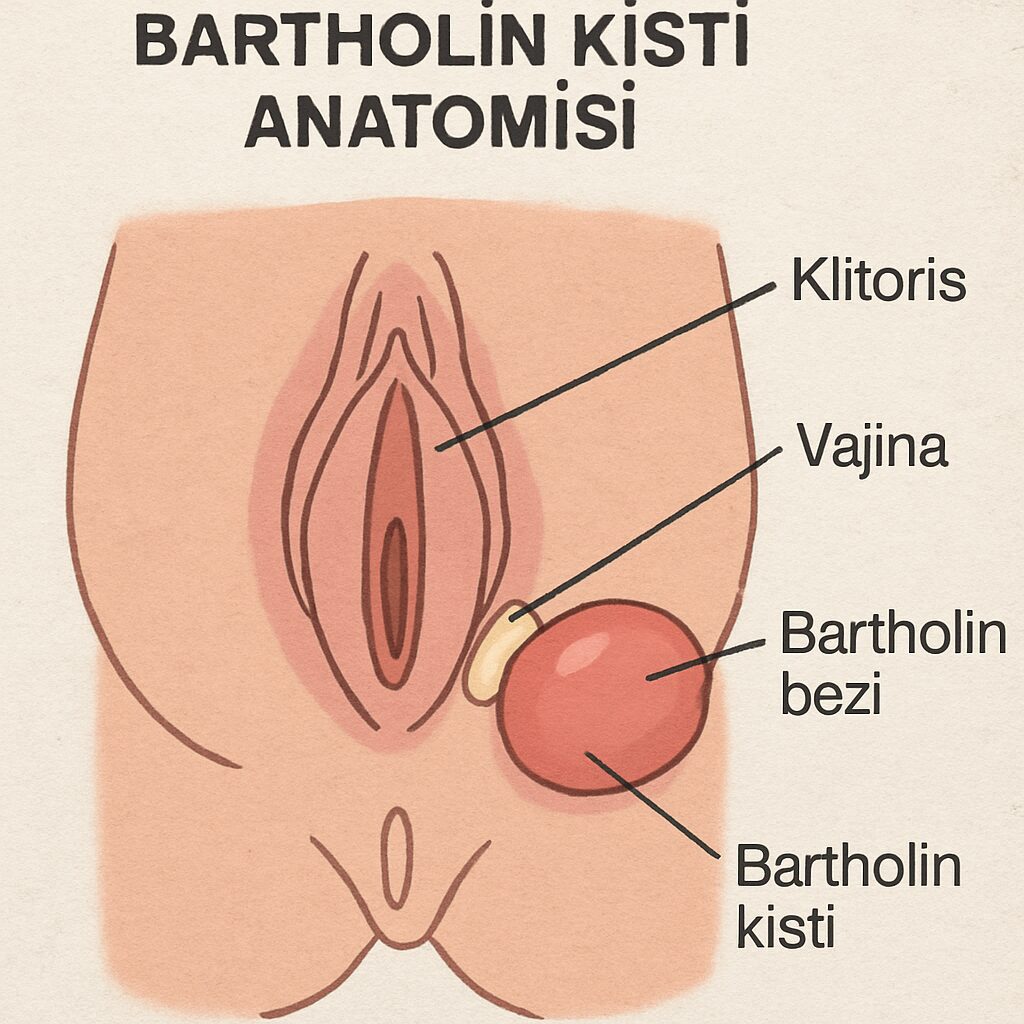Bartholin Kisti: Nedenleri ve Çözümleri