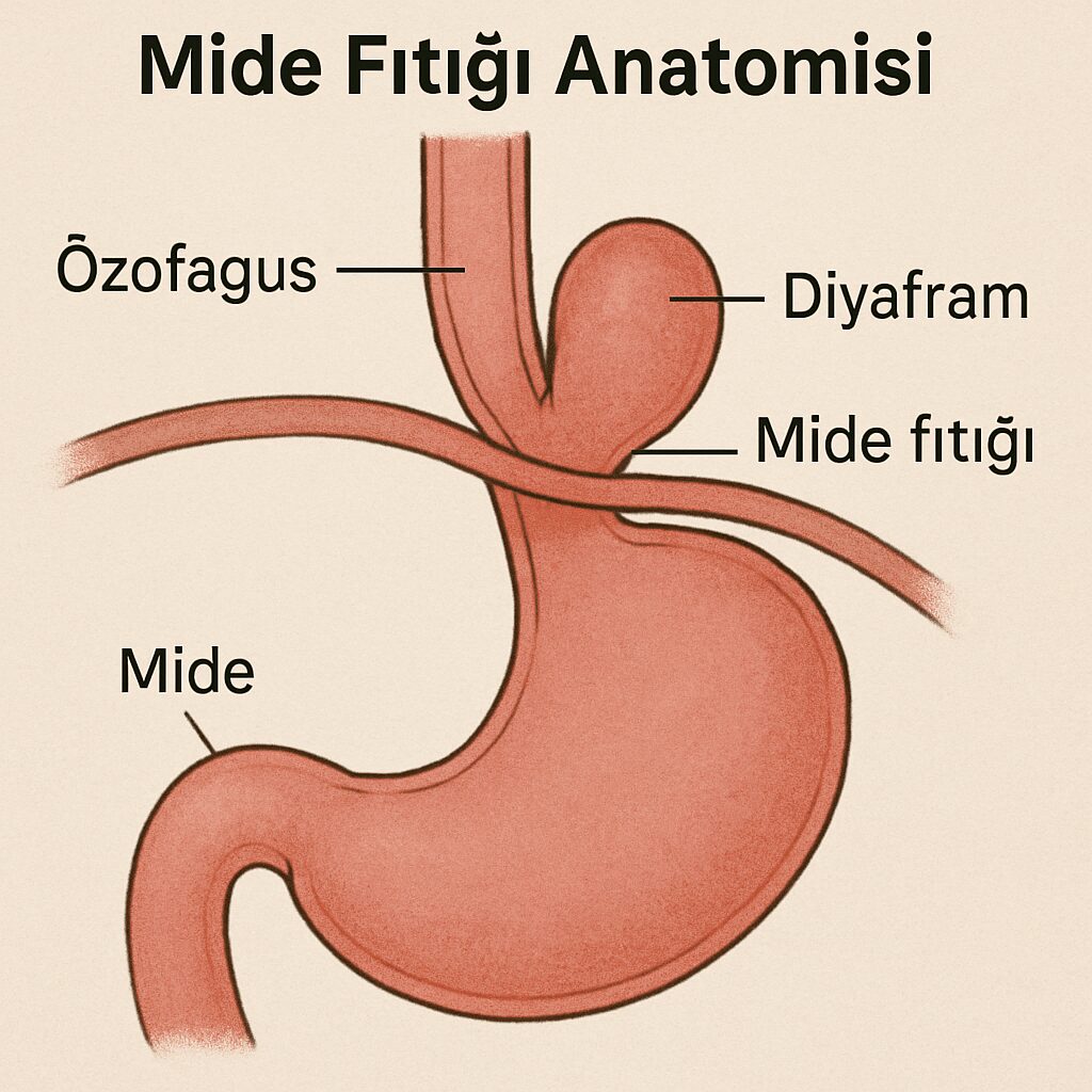 Mide Fıtığı: Nedenleri ve Çözümleri